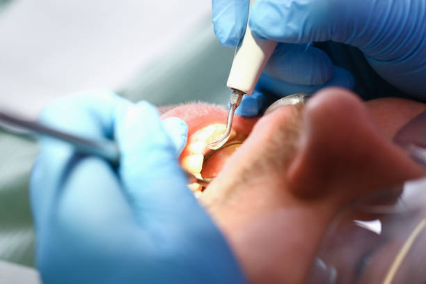 Best Emergency Broken Tooth Repair in Summit View, WA