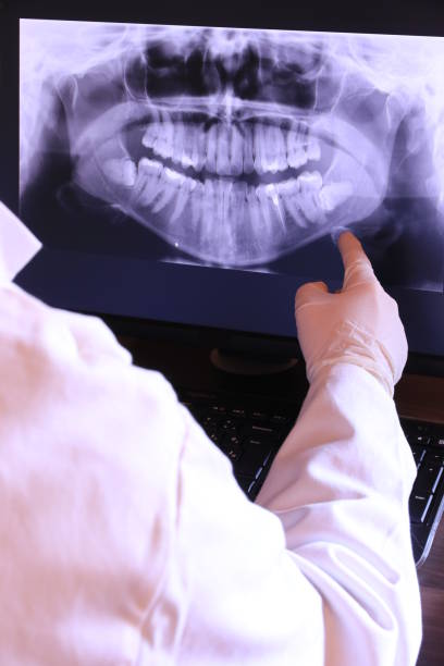 Best Emergency Tooth Extraction in Summit View, WA